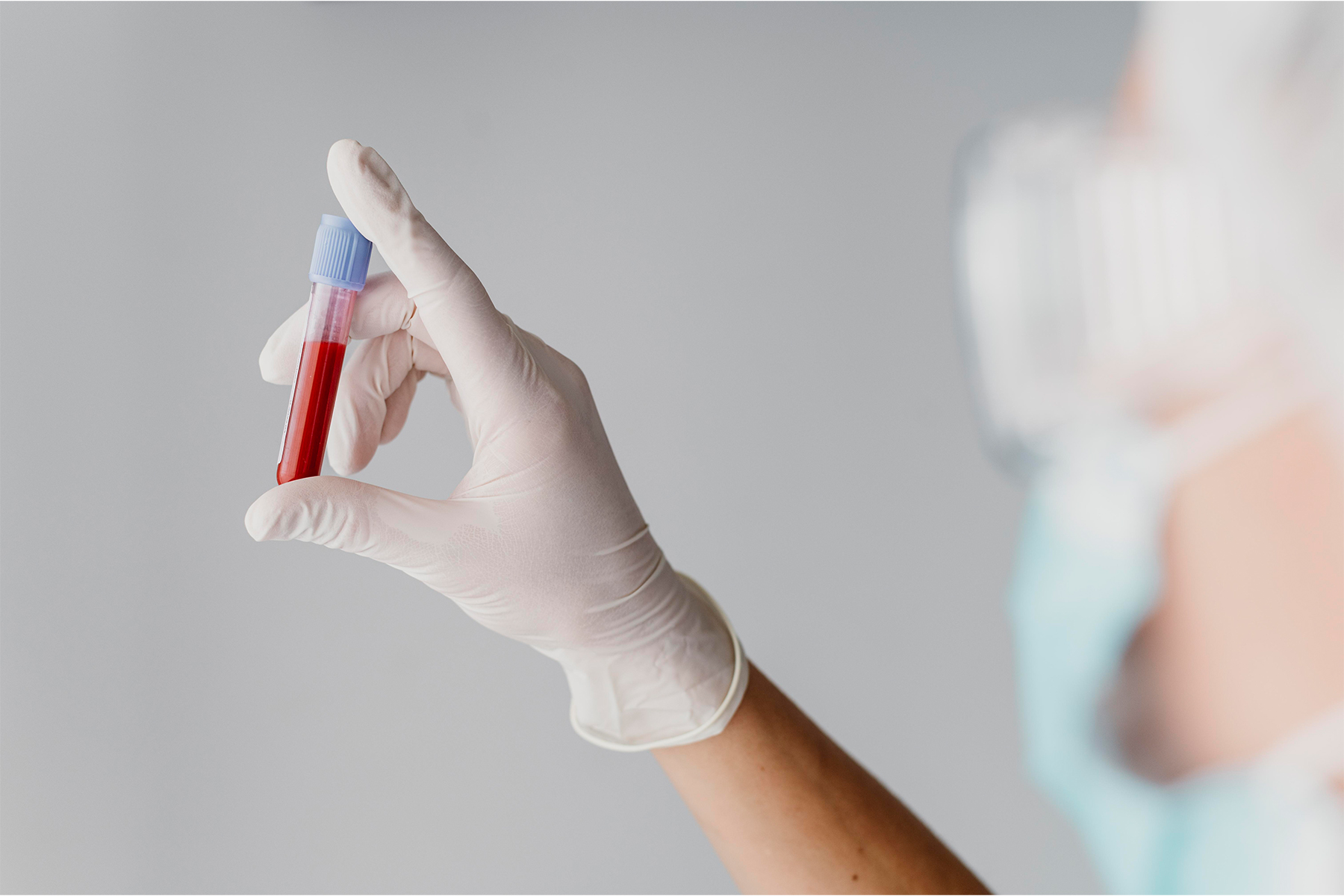Discover comprehensive diagnostic methods for leg vein diseases like varicose veins and deep vein thrombosis. Learn about non-invasive, minimally invasive, and specialized tests to ensure early detection and effective treatment.